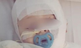 布里斯班公园婴儿被咖啡烫伤事件最新进展