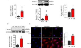 研究发现YTHDF1通过增强AXL翻译促进心脏纤维化