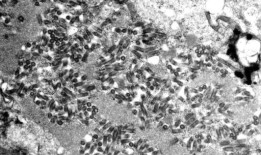 恩格尔伍德的小狗收养事件可能使人们暴露于狂犬病：CDPHE