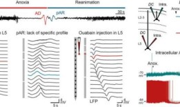 脑动力学的“死亡浪潮”首次凸显