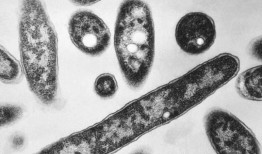 导致军团病爆发的冷却塔被发现