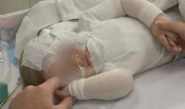 “给你世界上所有的力量”：澳大利亚人集会支持在布里斯班被咖啡袭击的男婴