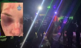 她回来了!泰勒·斯威夫特在NFL回归时为特拉维斯·凯尔斯欢呼