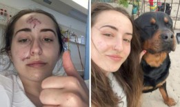 狗袭击：被朋友的狗咬伤的珀斯女子海莉·欧文斯分享了重要的警告