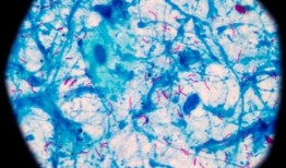 海洋细菌可能是对抗结核病的关键