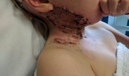 威尔士：妈妈分享的照片是每个父母在篝火之夜应该看到的