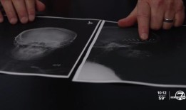 丹佛市区夜间发生6起枪击事件，造成3人死亡，7人受伤