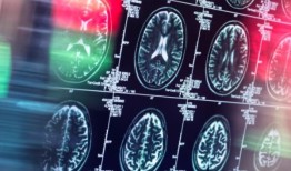 研究表明，阿尔茨海默病可以在人与人之间传播