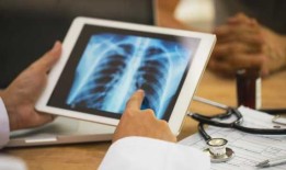 堪萨斯州的结核病爆发成为自1950年代以来美国最大的一次