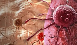 新的研究发现了16个有助于乳腺癌存活的基因