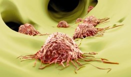 研究揭示脯氨酸代谢如何支持乳腺癌转移