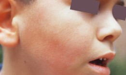 邓肯公园湖新ada无障碍码头剪彩